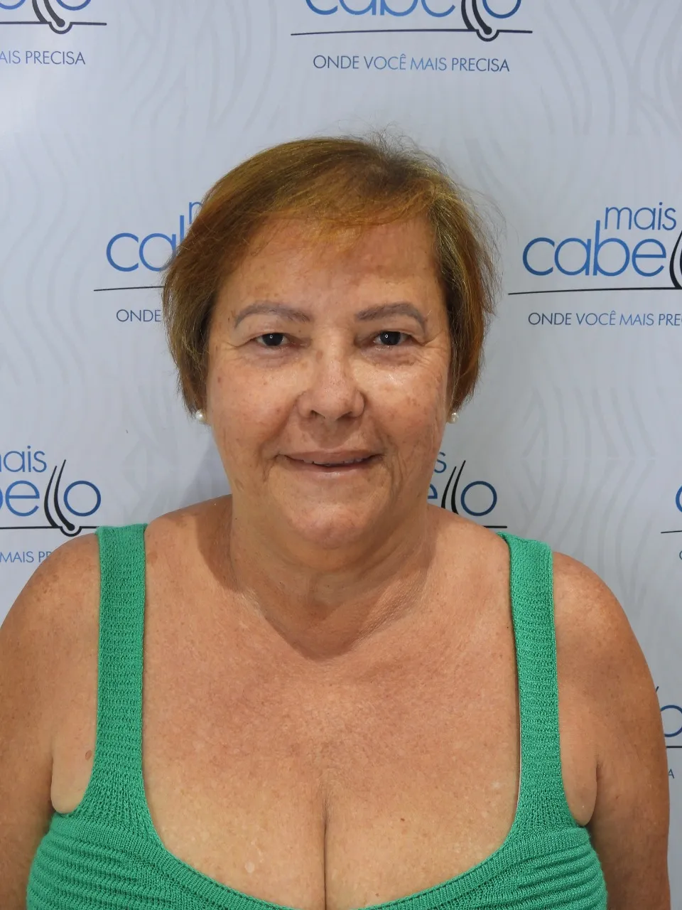 Ademiza, paciente Mais Cabello