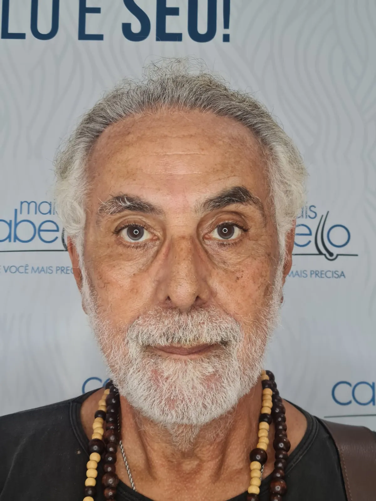 Anselmo Vasconcellos, paciente Mais Cabello