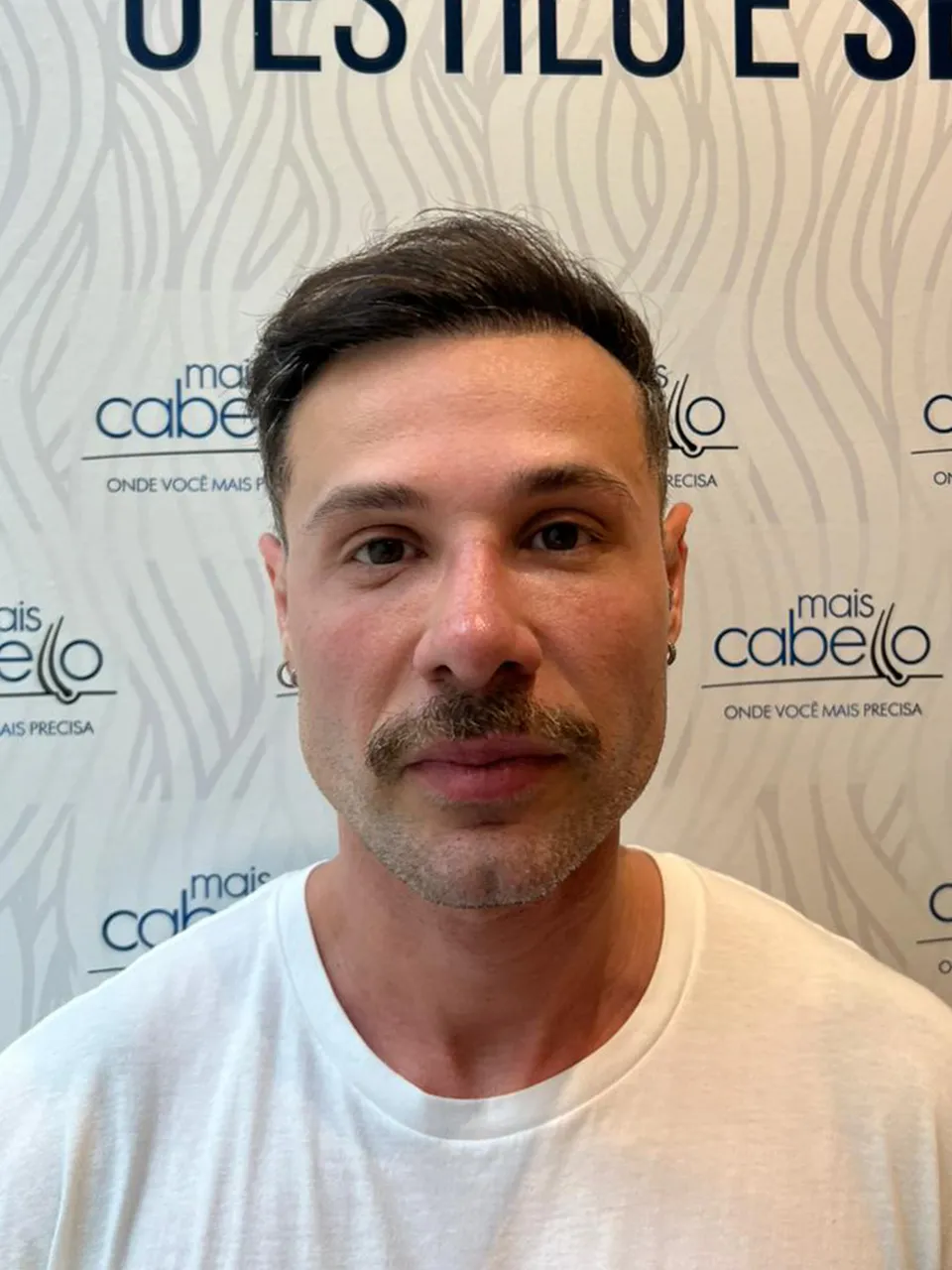 Alex Galette, paciente Mais Cabello