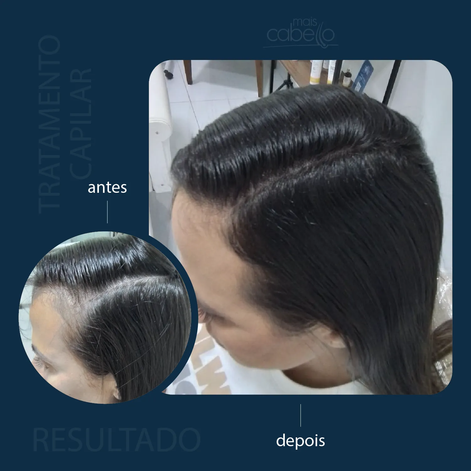 Antes e Depois - Tratamento Capilar Feminino