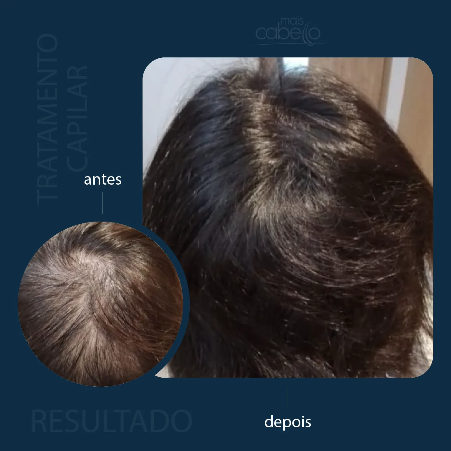 Antes e Depois - Tratamento Capilar Feminino
