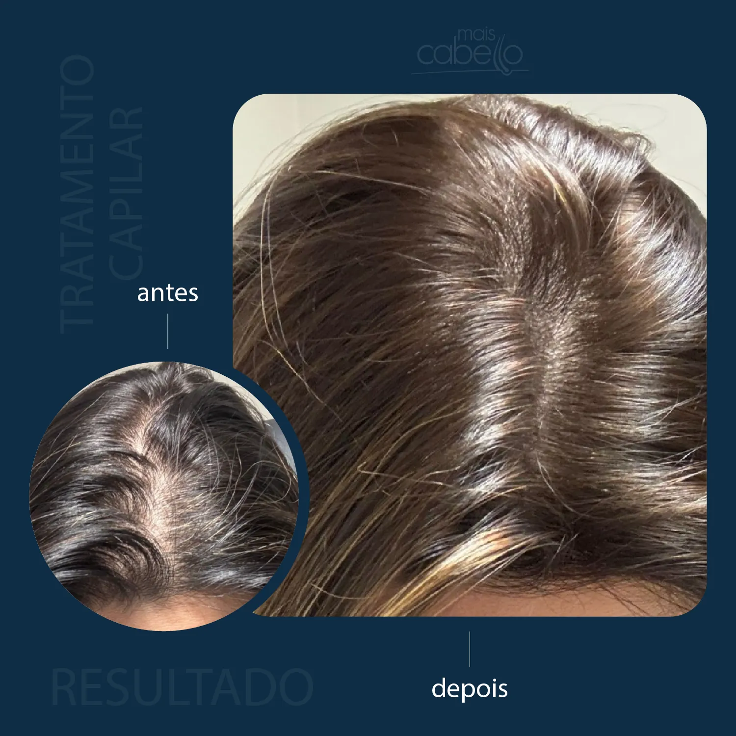 Antes e Depois - Tratamento Capilar Feminino